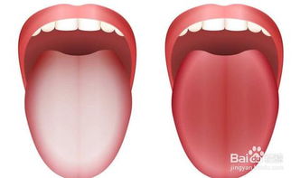 舌头齿痕重如何调理?舌头齿痕重如何调理最好