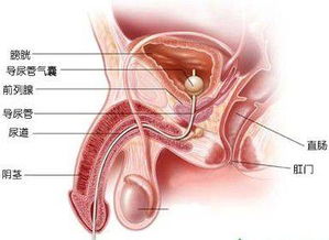 腹股沟直疝如何治疗?腹股沟直疝最有意义的临床表现