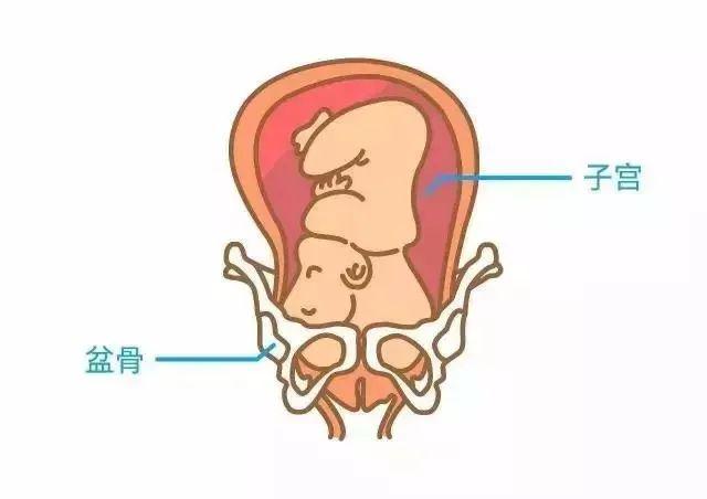 医生如何给孕妇测骨盆?骨盆窄的孕妇表现